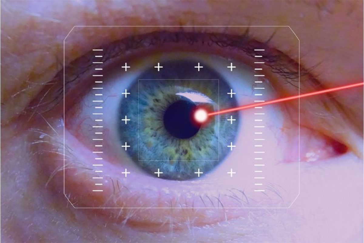 Laser Use in the Treatment of Myopia, Hyperopia and Astigmatism