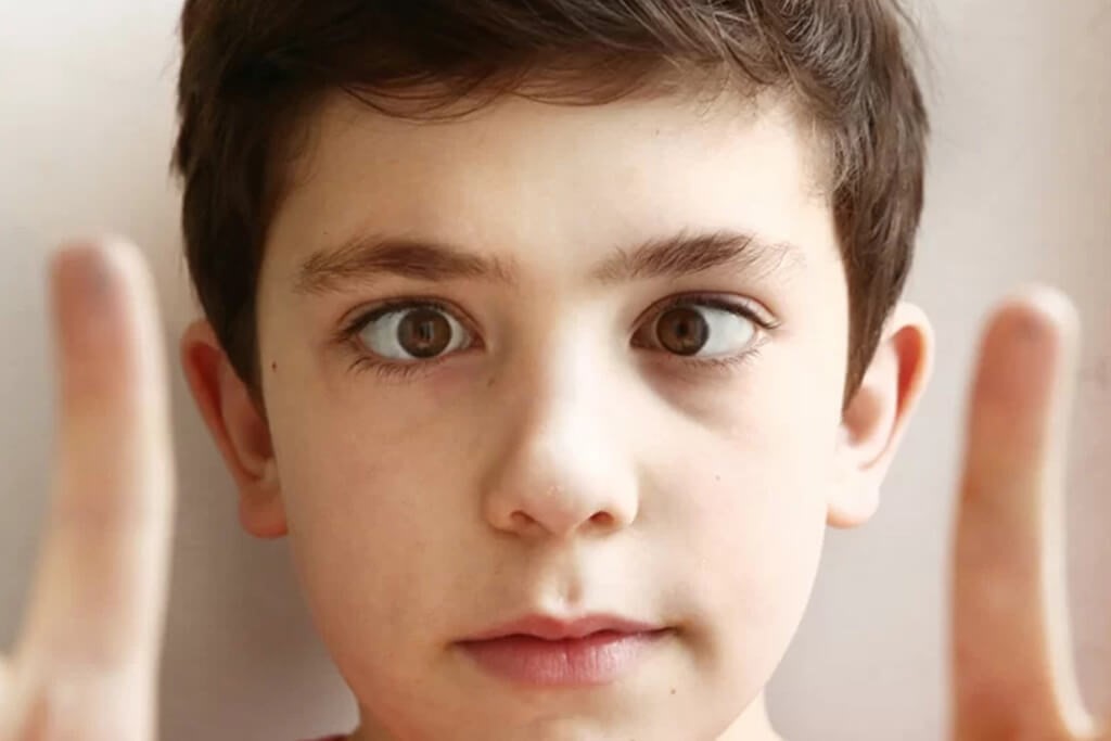 Strabismus in Children